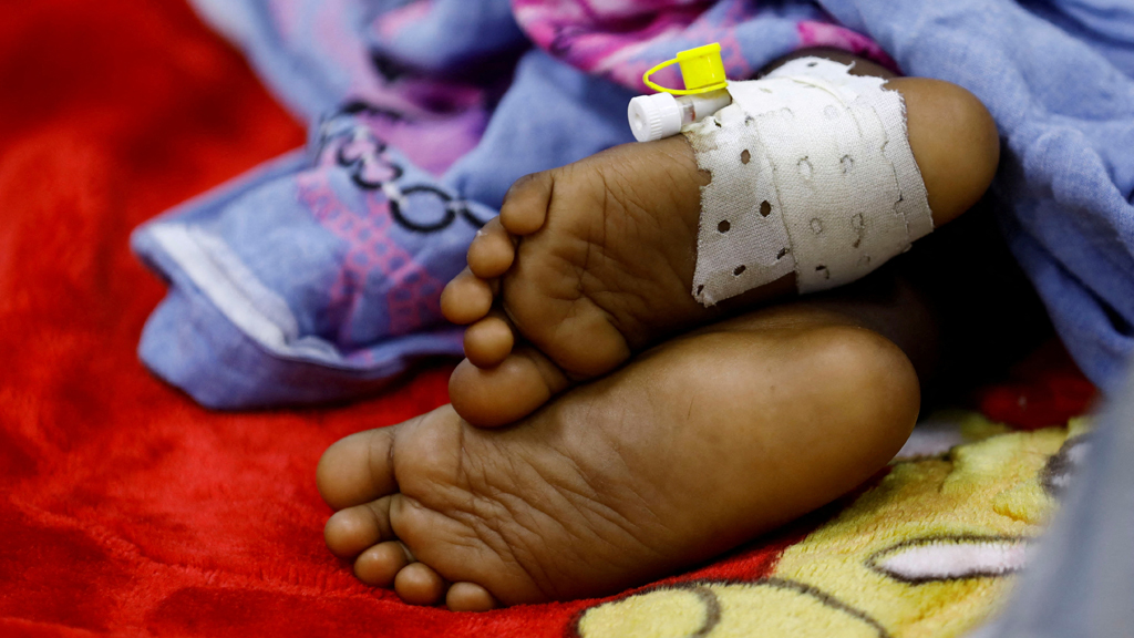 A child suffering from diphtheria rests inside a ward at De Martino Public Hospital, following a diphtheria outbreak, in Mogadishu, Somalia Aug 13, 2025. REUTERS/Feisal Omar/File Photo