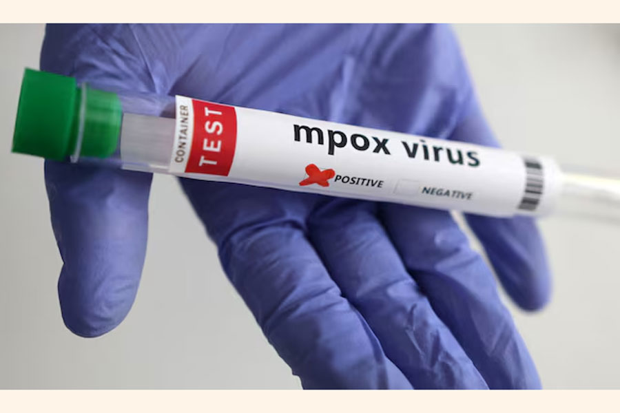 A test tube labelled "Mpox virus positive" is held in this illustration taken August 20, 2024.