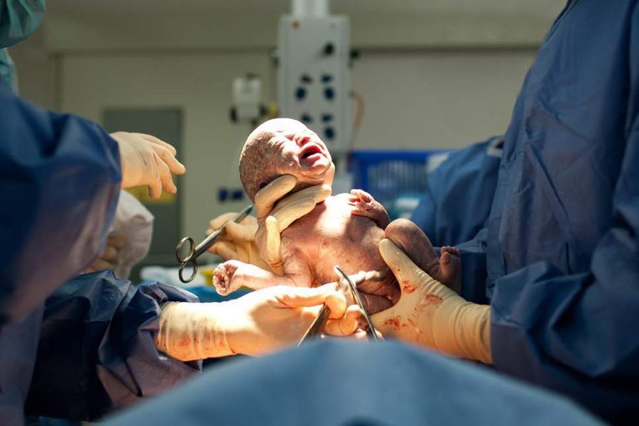 Photo: Collected from internet