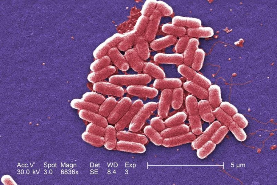 The mcr-1 plasmid-borne colistin resistance gene has been found primarily in Escherichia coli, pictured — Reuters/CDC